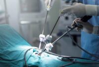 1761717097426-ilustrasi-operasi_169