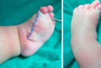 1763874368940-penemuan-bocah-jari-kaki-kiri-10-1763708319936_169