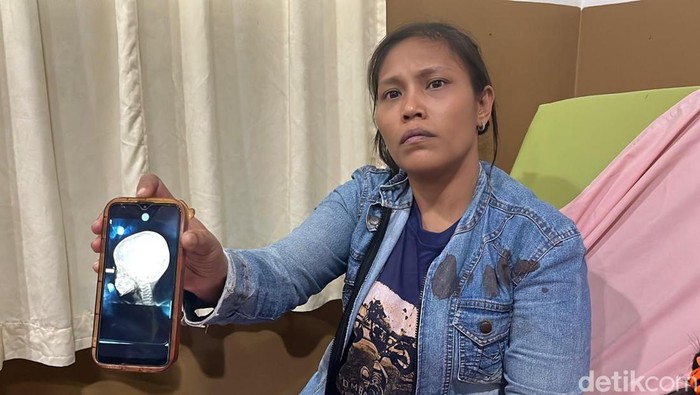 1767870370619-romanda-siregar-saat-diwawancarai-di-rsud-pirngadi-finta-rahyunidetiksumut-1767689805878_169